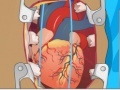 Spel Heart Surgery